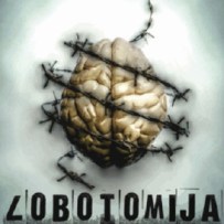 lobotomija